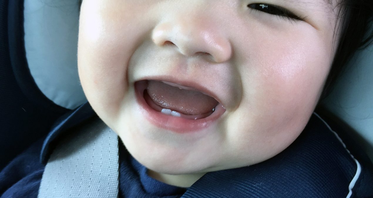Well hello there, two front teeth!