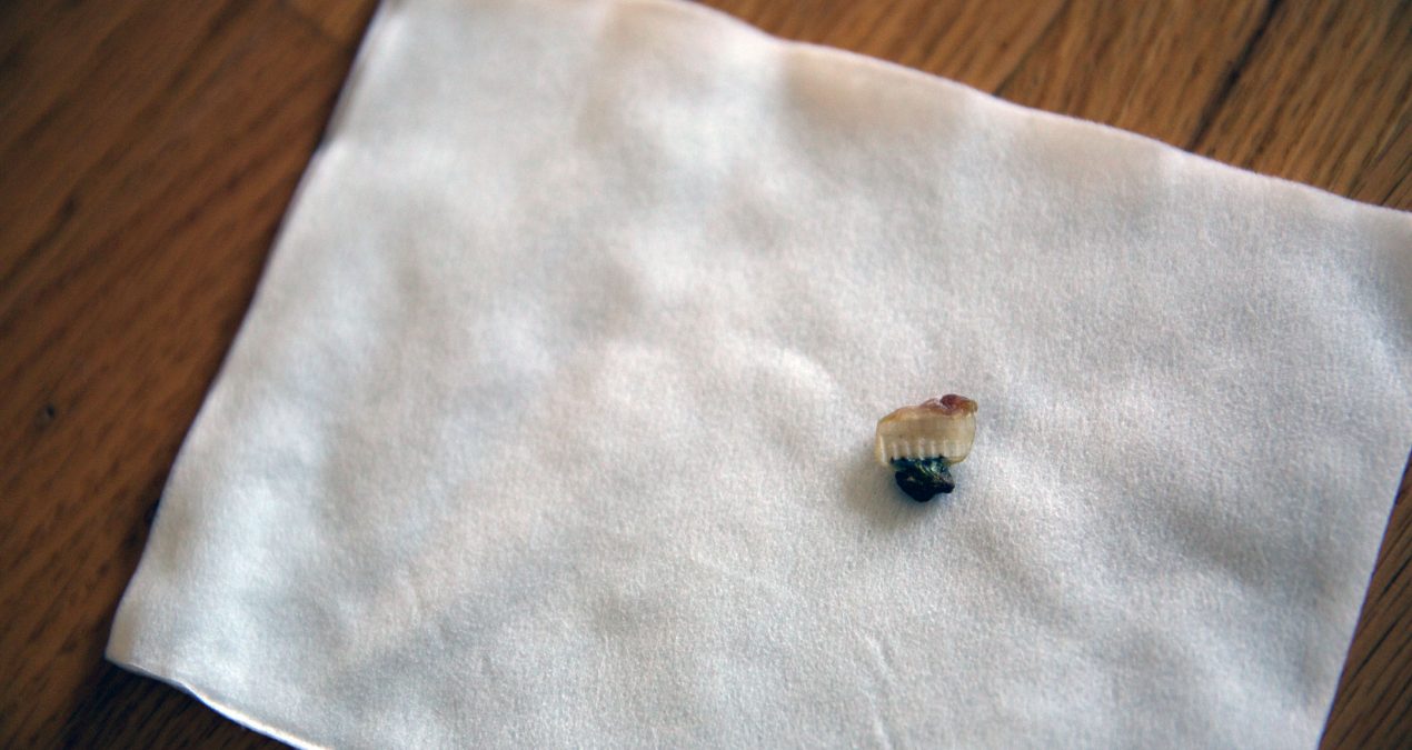 The umbilical cord stump fell off!