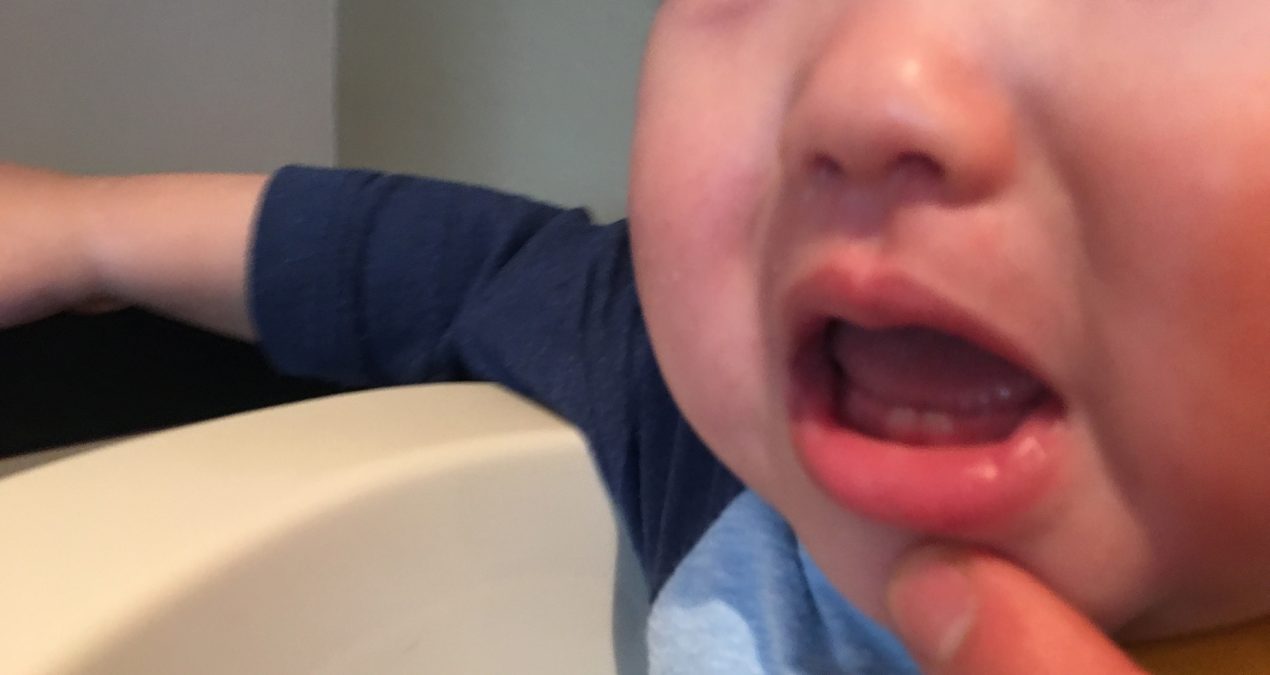 Jordan’s 2 front teeth!